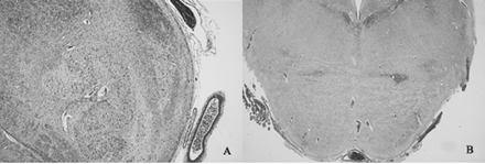 Fig 3.