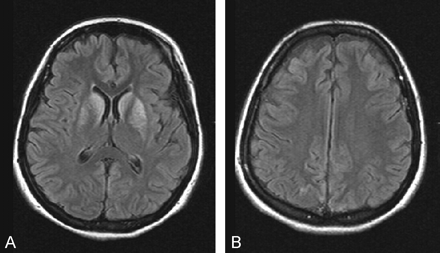 Fig 3.