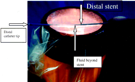Fig 2.