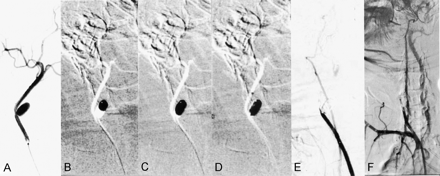 Fig 2.