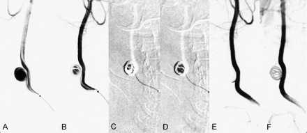 Fig 3.