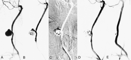 Fig 4.