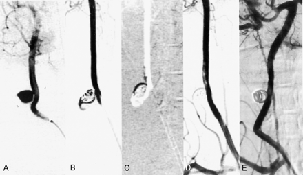 Fig 5.