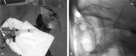 Fig 2.