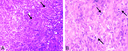 Fig 2.