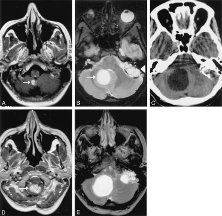 Fig 1.