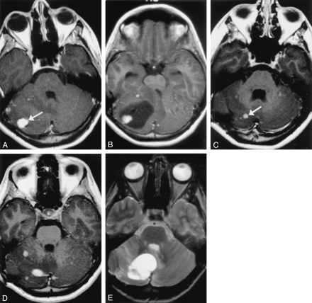 Fig 2.