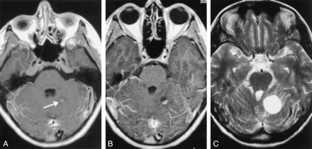 Fig 3.