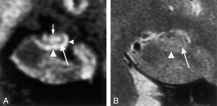 Fig 3.