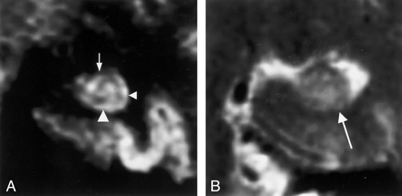 Fig 4.