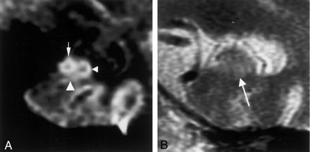 Fig 6.