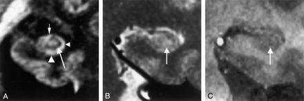 Fig 8.