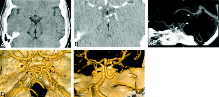 Fig 1.