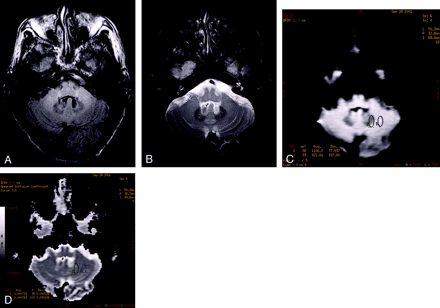 Fig 2.