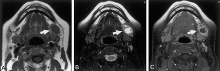 Fig 1.