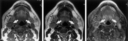Fig 2.