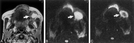 Fig 3.