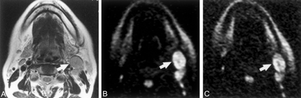 Fig 5.