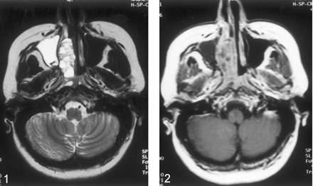 Fig 1.
