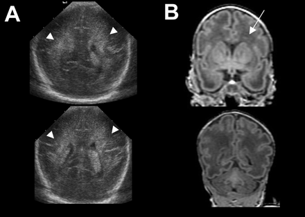 Fig 1.