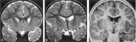 Fig 4.