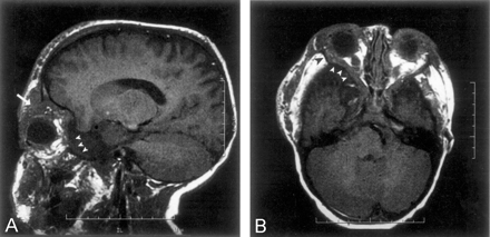 Fig 1.