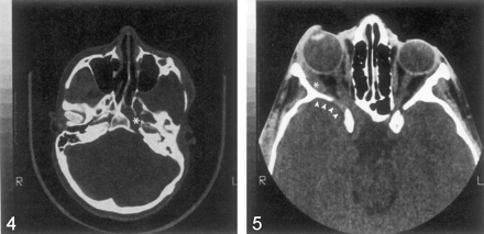 Fig 4.
