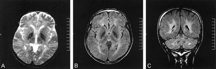 Fig 1.