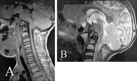 Fig 1.