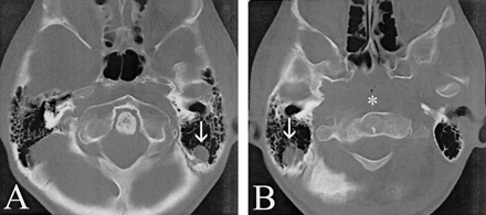 Fig 2.
