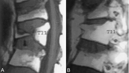 Fig 12.