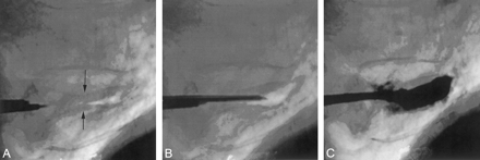 Fig 13.