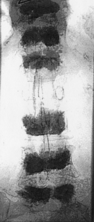 Fig 15.
