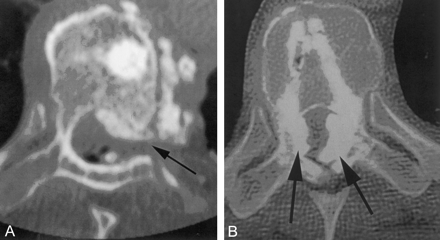 Fig 4.
