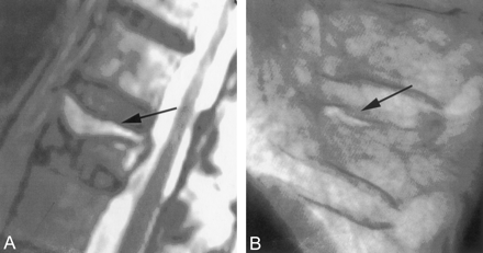 Fig 8.