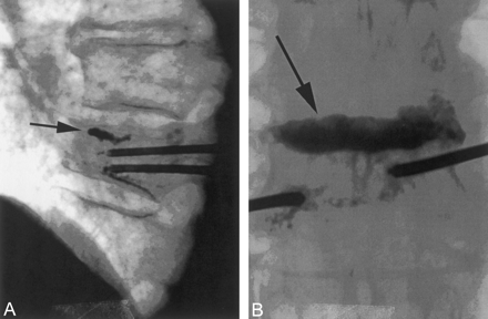 Fig 9.
