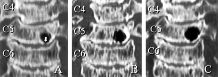 Fig 3.