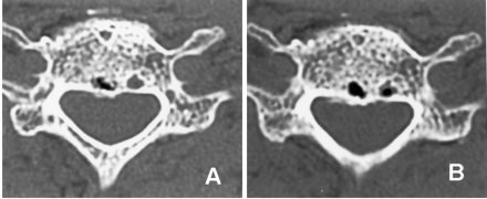 Fig 4.