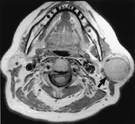 Fig 5.