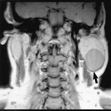 Fig 6.