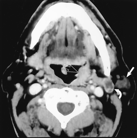 Fig 8.