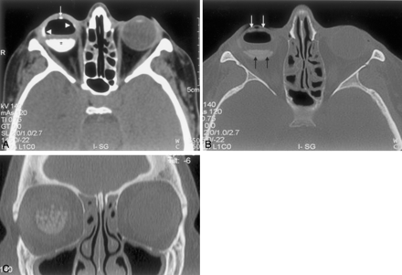 Fig 1.