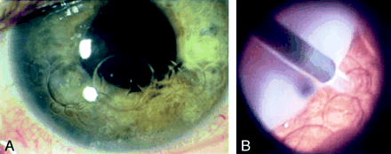 Fig 2.