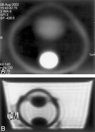 Fig 3.