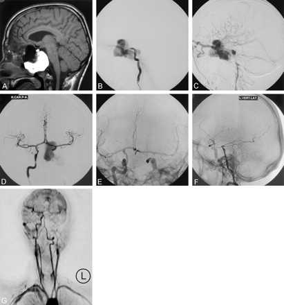 Fig 1.