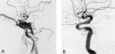Fig 3.