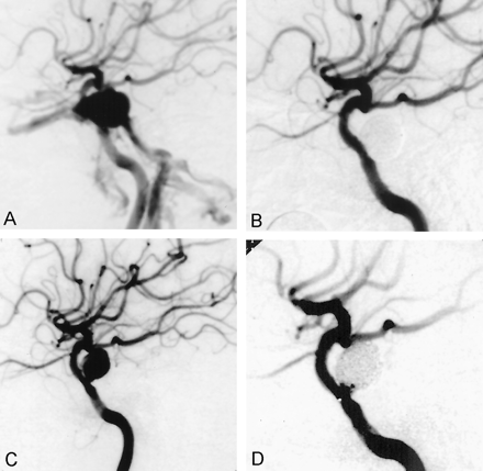 Fig 4.