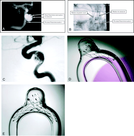Fig 1.