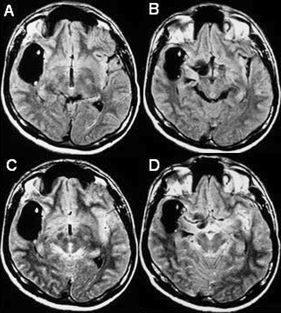 Fig 4.
