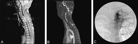 Fig 2.